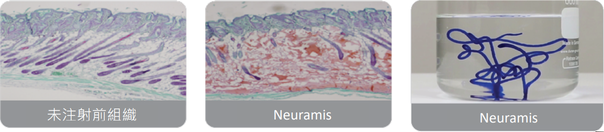 Neuramis仙女玻尿酸